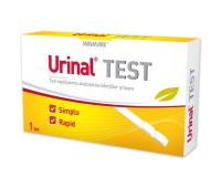 Urinal test