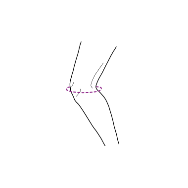 Orteza de genunchi simpla, elastica